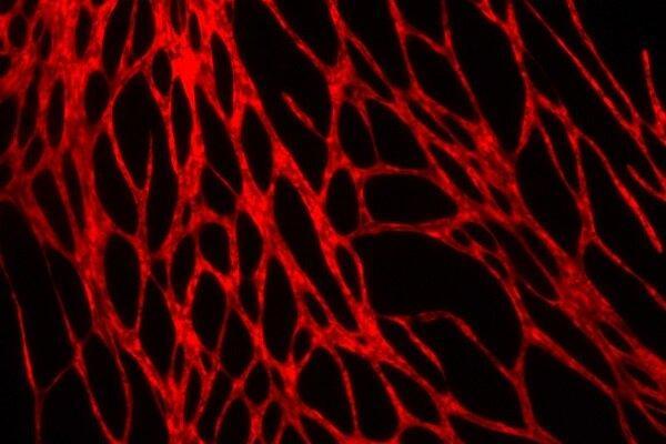 چاپ سه بعدی پوست زنده و مملو از رگ های خونی