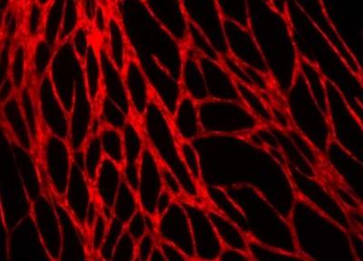 چاپ سه بعدی پوست زنده و مملو از رگ های خونی
